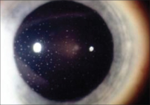 Descripción: Clinical examination revealed 7-mm probing depths, circumferentially around a mandibular implant, bleeding on probing, and the presence of exudate and gingival inflammatory edema