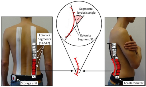 Descripción: Clinical examination revealed 7-mm probing depths, circumferentially around a mandibular implant, bleeding on probing, and the presence of exudate and gingival inflammatory edema